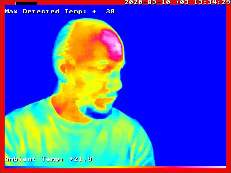 Fever Detected